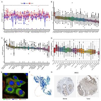 Transcriptome sequencing and single-cell sequencing analysis identify GARS1 as a potential prognostic and immunotherapeutic biomarker for multiple cancers, including bladder cancer